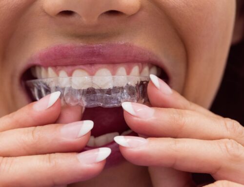 Invisalign vs. Traditional Braces: Which is the Right Choice for You?