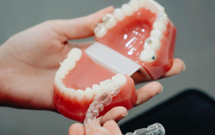 Aligners (invisalign) near me Redwood City