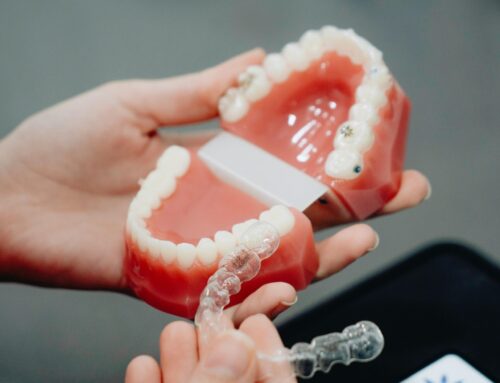 How Invisalign Works: A Step-by-Step Guide