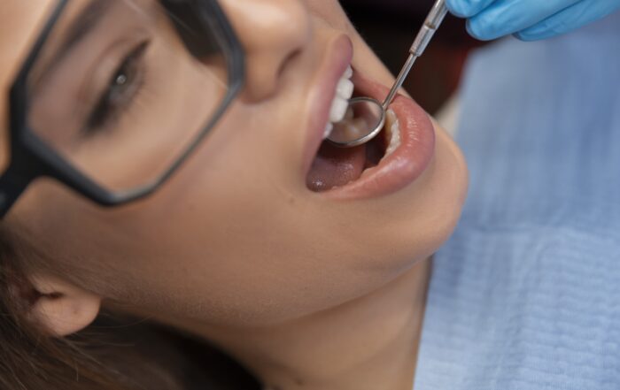 Pain Management During and After Dental Filling Near Redwood City