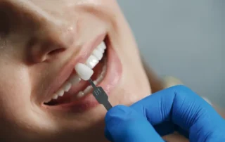 How to Choose the Right Dental Crown Provider near me in Redwood City