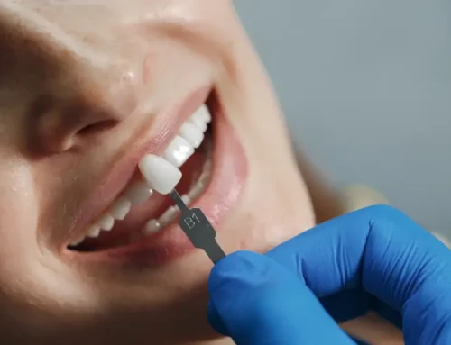 How to Choose the Right Dental Crown Provider in Redwood City