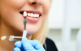 Are Veneers Worth It? A Redwood City Dentist Explains