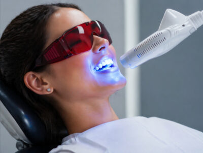 Teeth Whitening Redwood City Ca